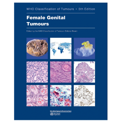 WHO's Classification of Tumours: Breast Tumours; 5th Edition 2019